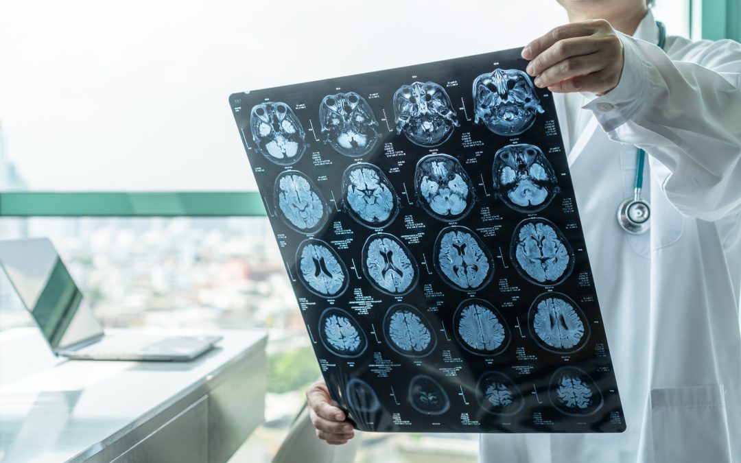 CreateAbility Celebrates National Brain Injury Awareness Month